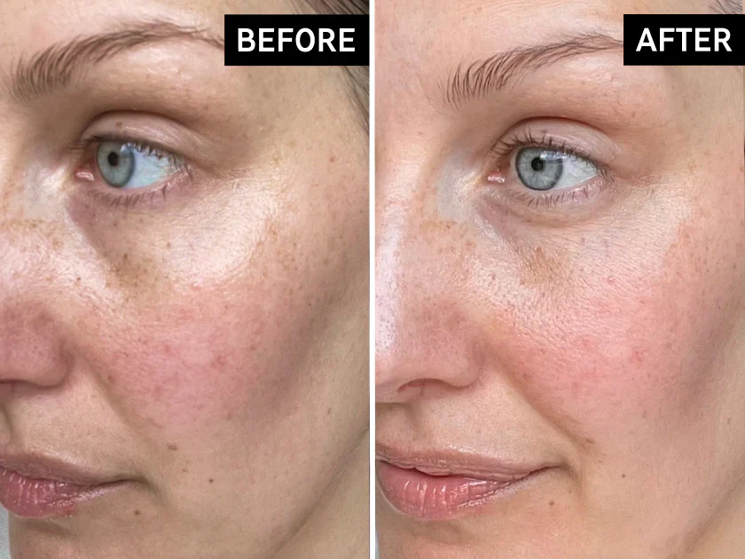 Knowledge-Powered Skincare Made Simple